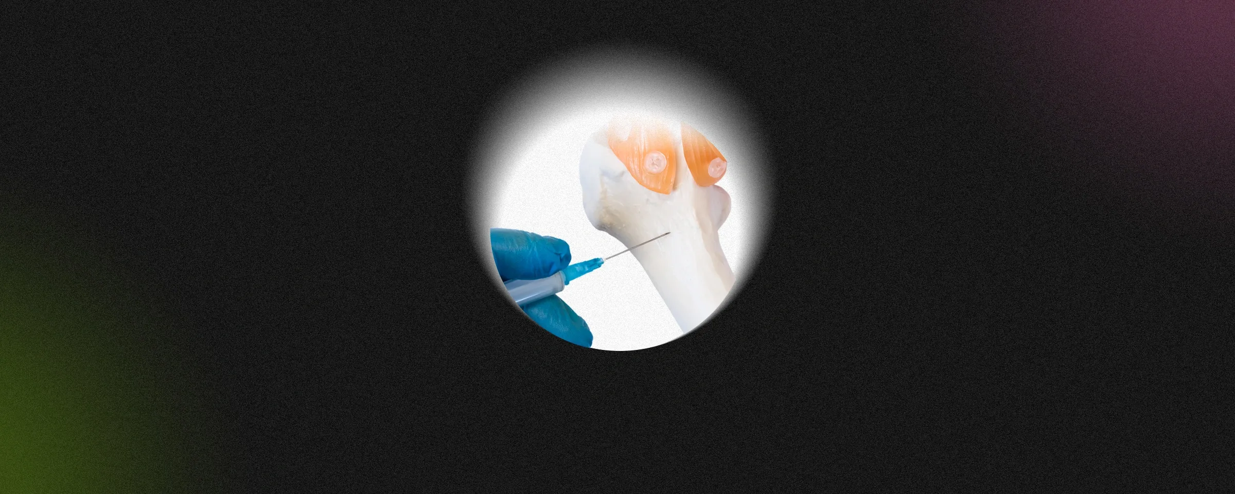 Bone Marrow Biopsy and Aspiration: What They Are and Why They Matter