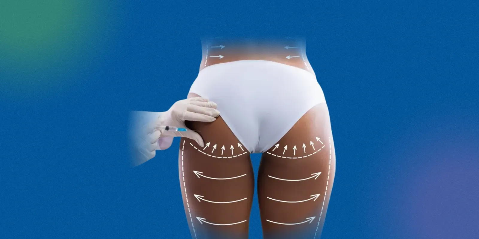 Buttock Lift Surgery