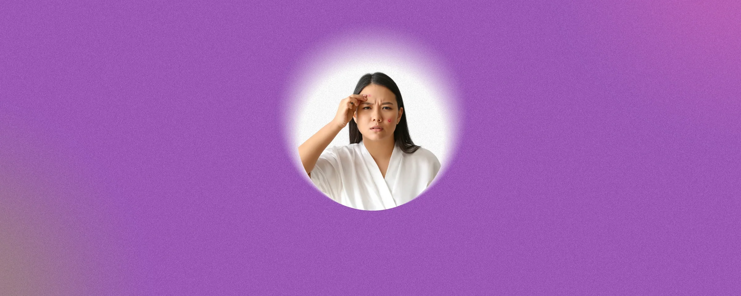 How To Get Rid of Acne: Effective Home Remedies for Pimples