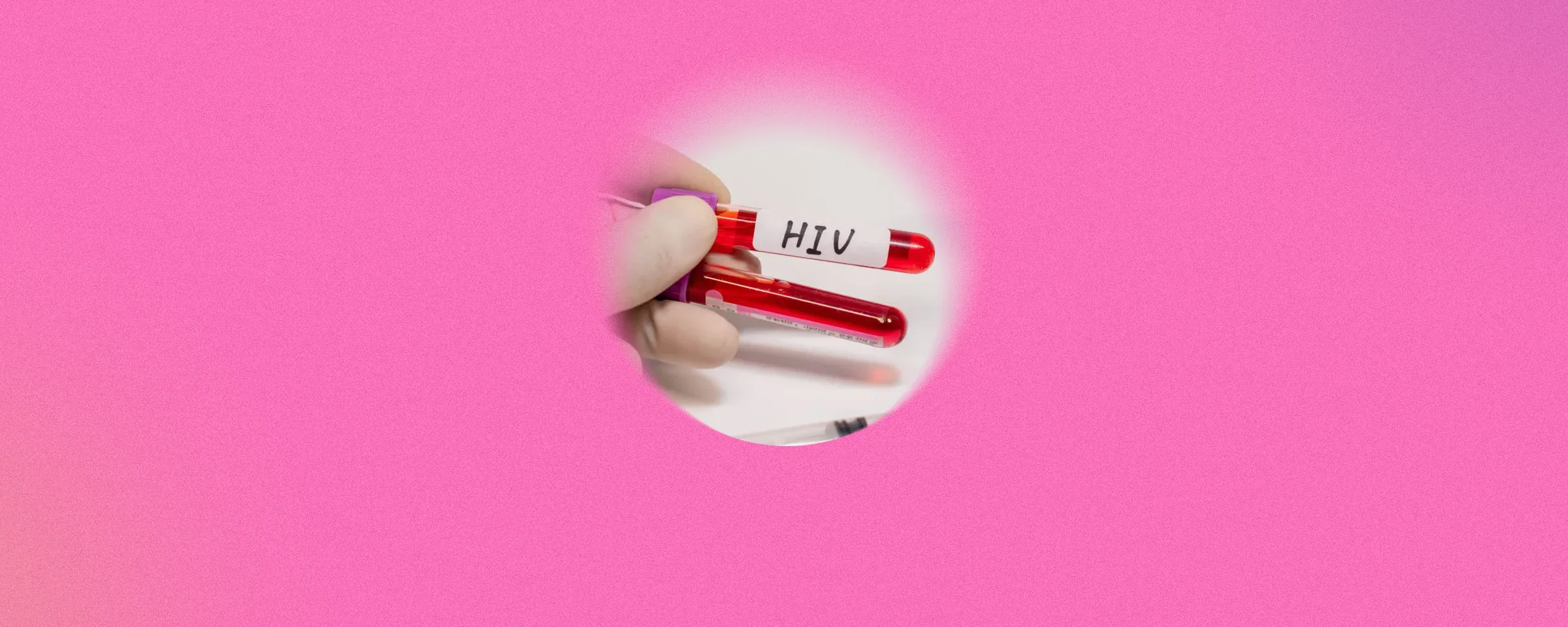 What To Know About HIV Wasting Syndrome