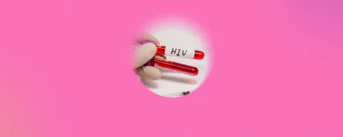 What To Know About HIV Wasting Syndrome